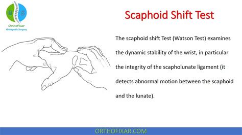 schaphoid compression test evidence|watson scaphoid shift test.